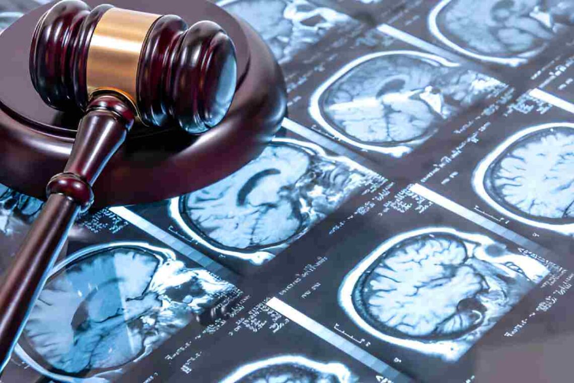 Traumatic Brain Injuries: Legal Rights for Victims and Families